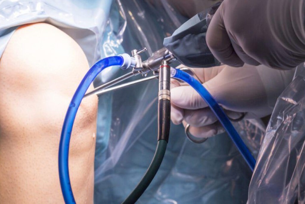 Artroscopia de Rodilla en Tijuana BC Traumatologo Ortopedista en Tijuana https://traumatologoentijuana.com