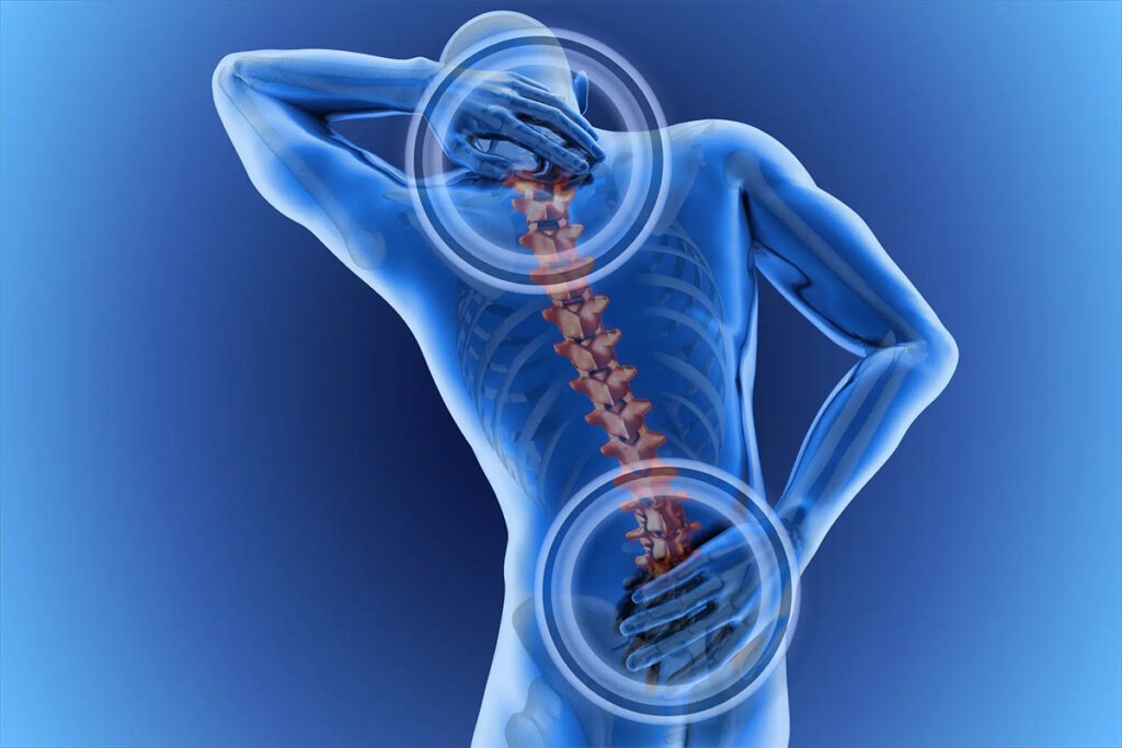 Fracturas 7 Fractura de Columna en Tijuana Traumatologo Ortopedista en Tijuana https://traumatologoentijuana.com