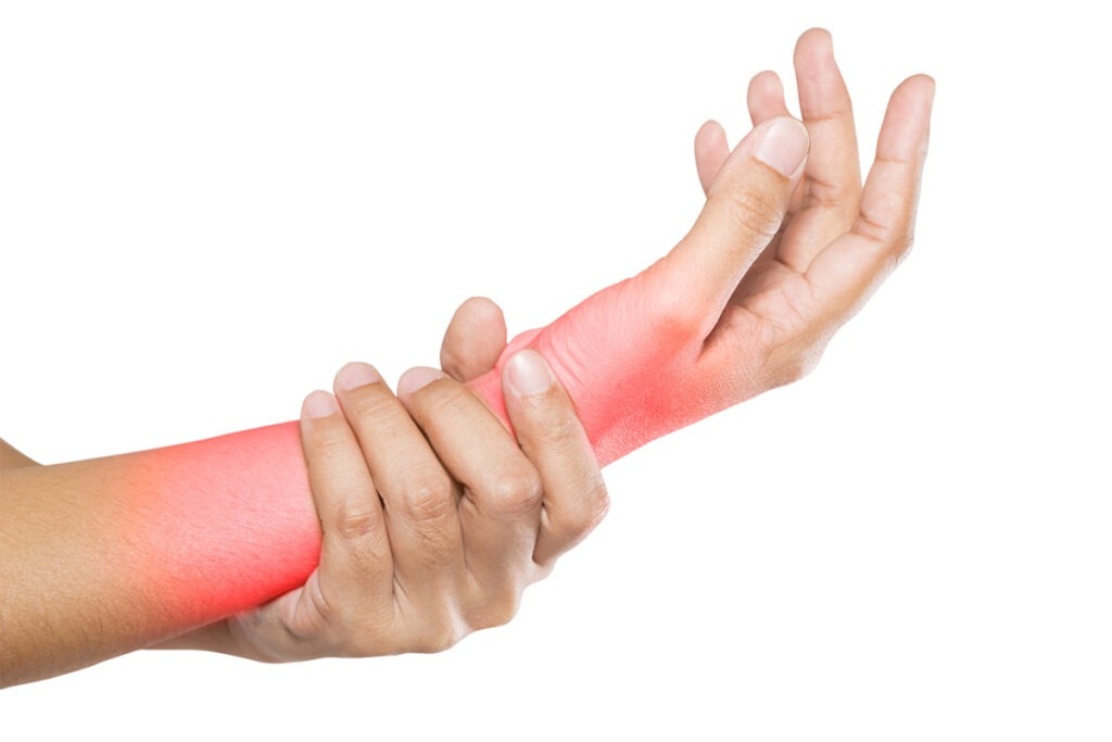 Fracturas 8 Fractura de Muneca en Tijuana Traumatologo Ortopedista en Tijuana https://traumatologoentijuana.com
