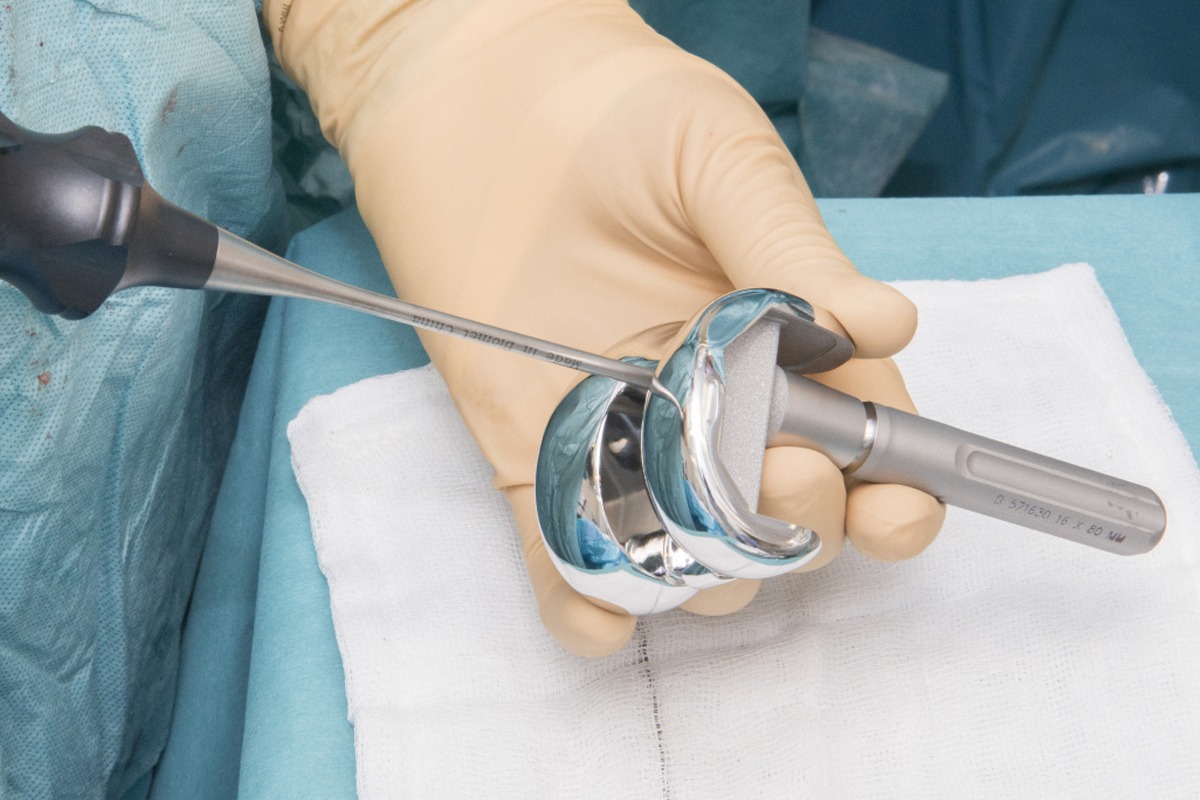 Reemplazo Protesis de Rodilla en Tijuana