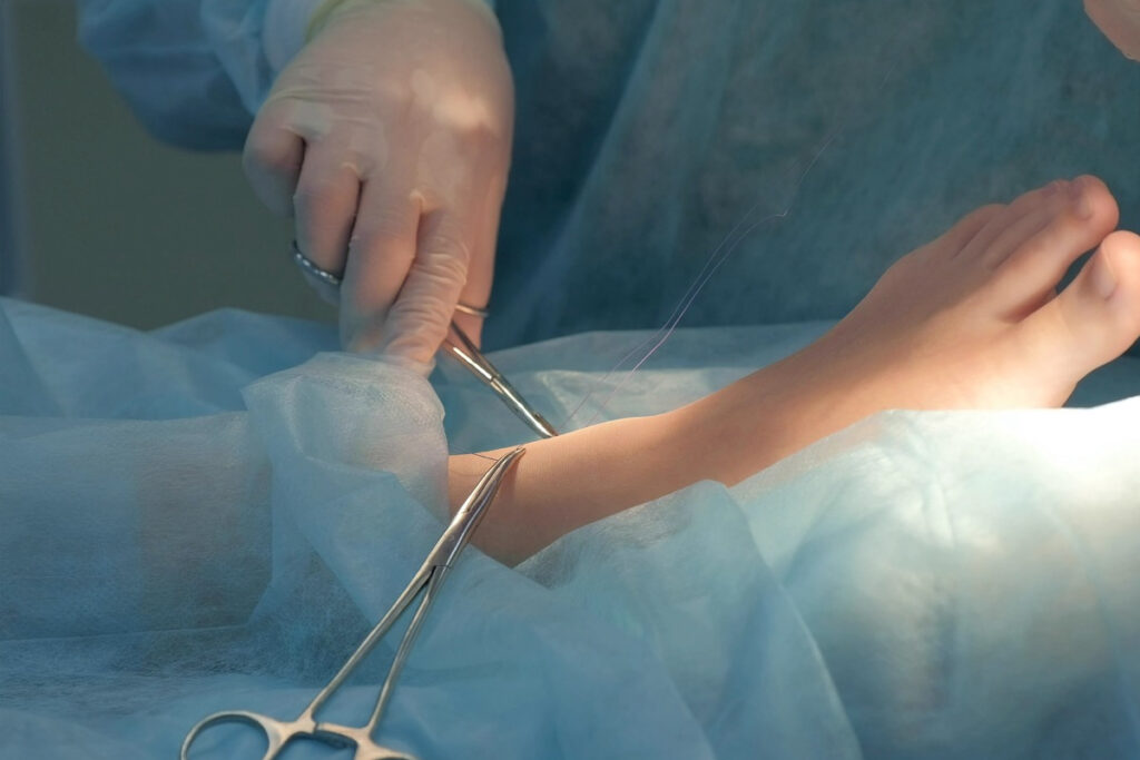 Especialista en Fractura de Tobillo en Tijuana 8 cirugia de tobillo en tijuana Traumatologo Ortopedista en Tijuana https://traumatologoentijuana.com